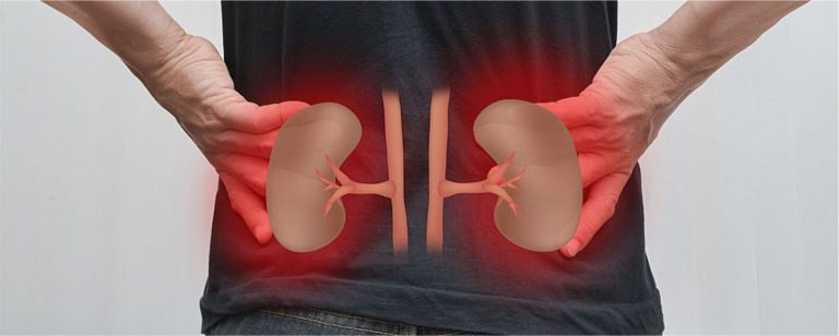 Cuidado de pacientes con insuficiencia renal crónica