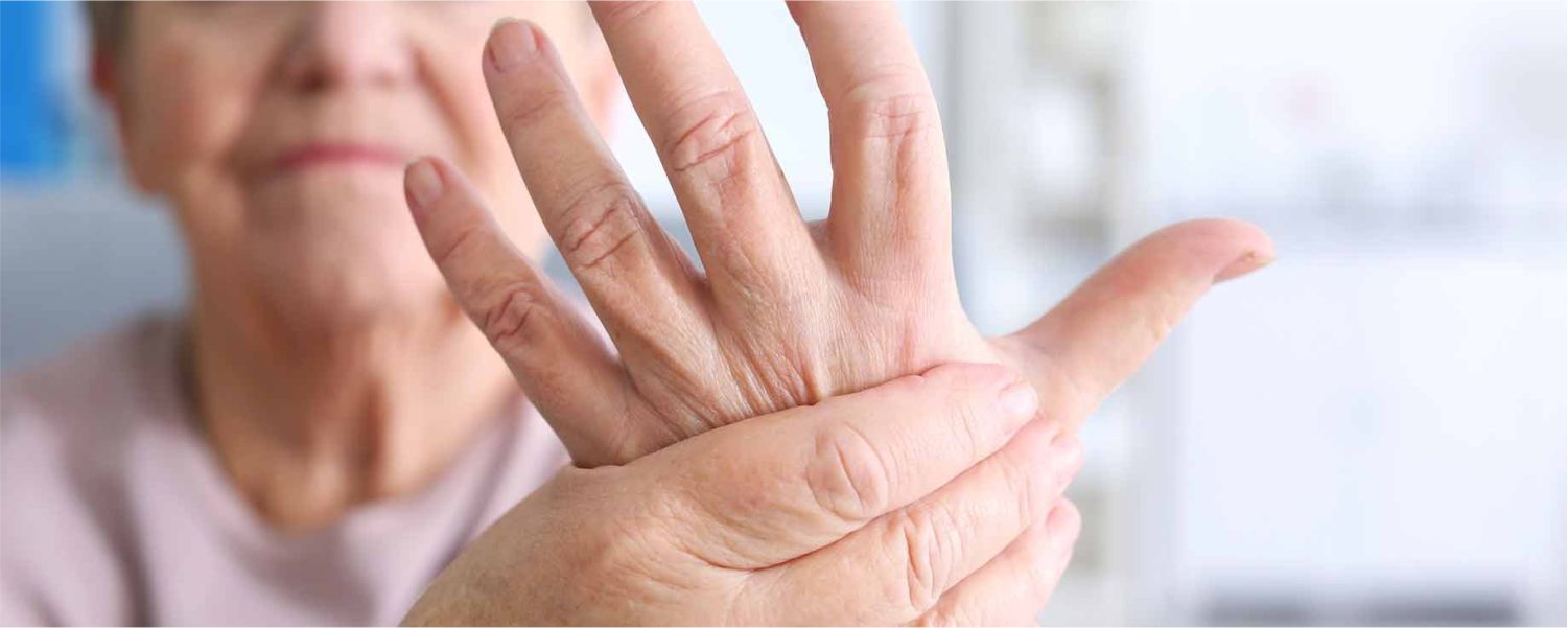 Manejo del dolor en pacientes con artritis reumatoide