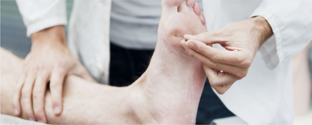 Cuidado del pie diabético: Prevención y tratamiento