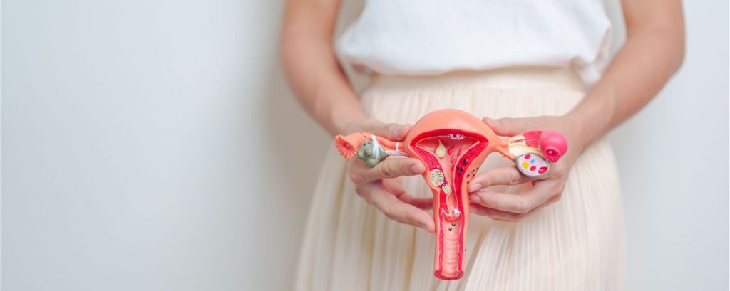 Tratamiento y prevención del síndrome de ovario poliquístico (SOP)