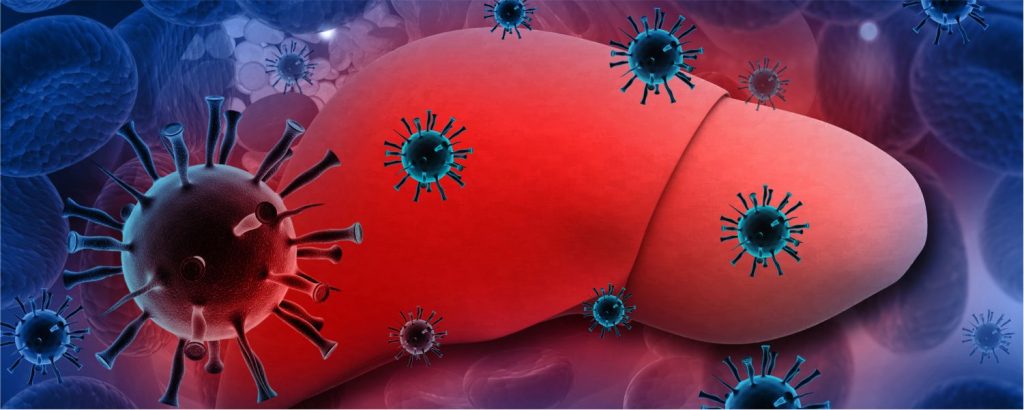 Hepatitis: Tipos, síntomas y prevención